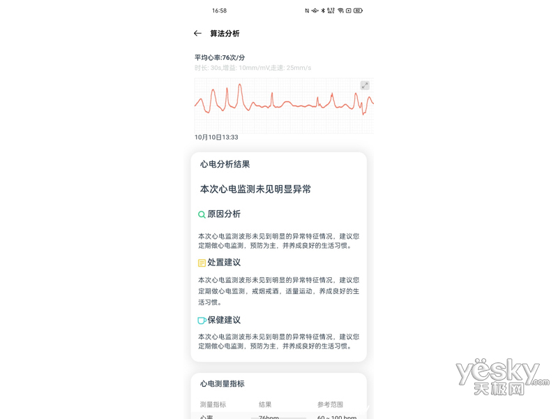 OPPO Watch ECG��